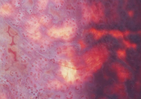 Quelle méthode est la plus efficace pour utiliser la résine de CBD ?